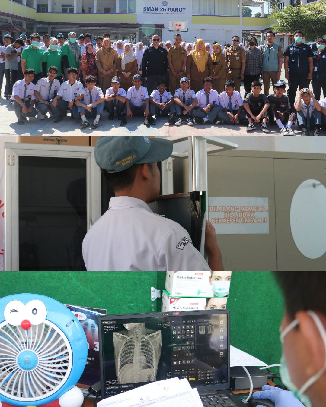 Deteksi Dini TBC, SMAN 25 Garut Laksanakan Skrining Kesehatan dan Rontgen